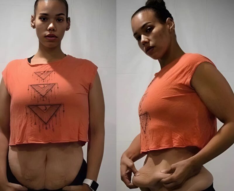 « D’une tragédie évitée de justesse à un triomphe ! » La transformation spectaculaire de cette jeune femme inspire des milliers de personnes