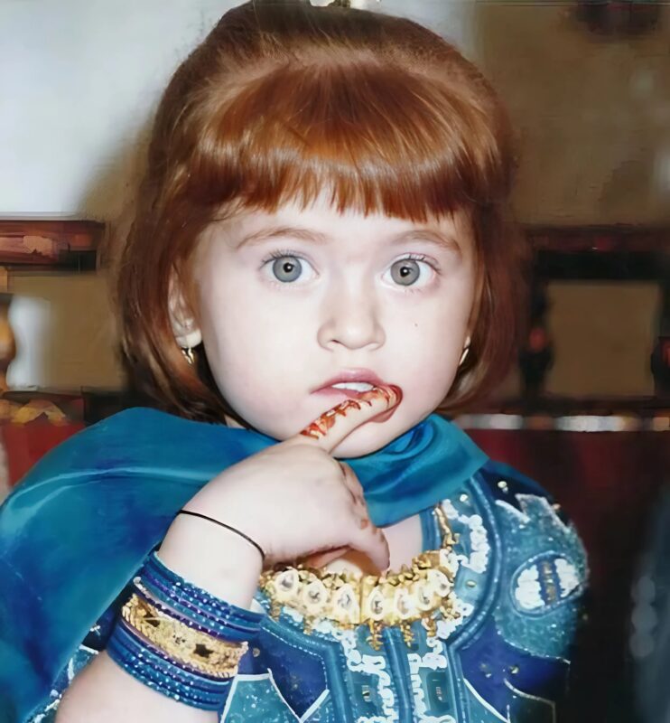 Pour une petite fille indienne elle est née avec une apparence inhabituelle
