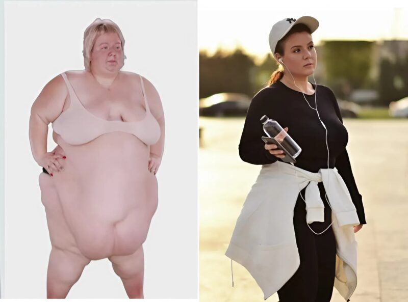 À 30 ans son poids atteignait 227 kg et elle pouvait à peine marcher